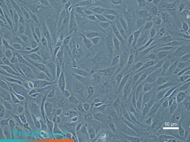 Human Pulmonary Great Vein Endothelial Cell Complete Medium - 6