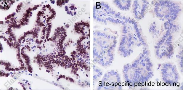 Recombinant JunB Monoclonal Antibody - 2