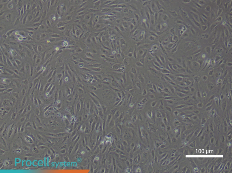 Human Pulmonary Arteriolar Endothelial Cell Complete Medium - 3