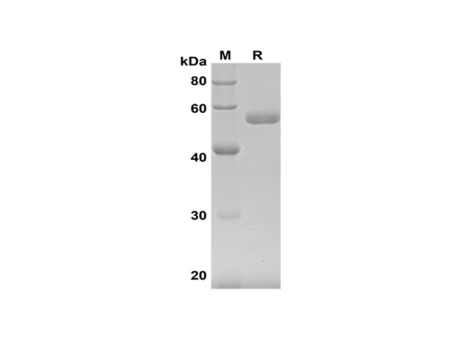 Recombinant Rat TNF-αsf Protein(His Tag)-产品推荐-1