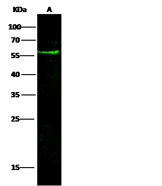 Recombinant Coagulation Factor III/Tissue Factor/CD142 Monoclonal Antibody-searchlist-1