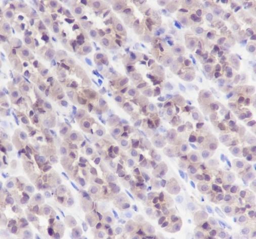 Recombinant GST3/GSTP1 Monoclonal Antibody - small - 4