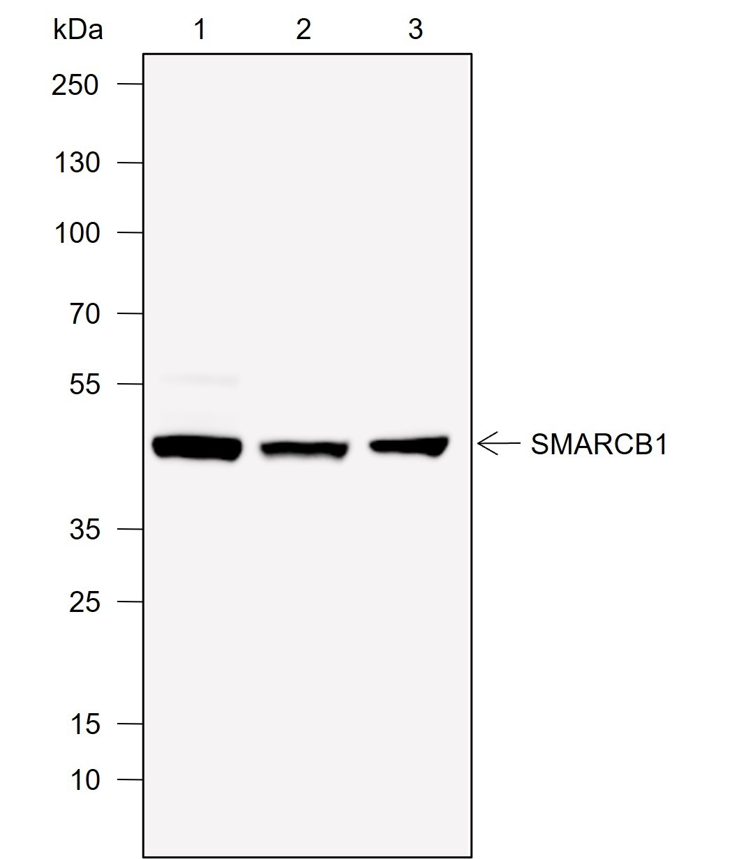 Recombinant SMARCB1/BAF47 Monoclonal Antibody-searchlist-1