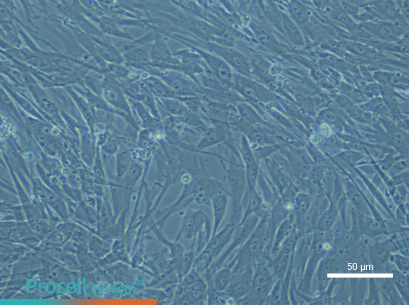 Human Preadipocyte Complete Medium - small - 6