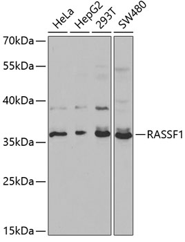 Western blot analysis of extracts of various cell lines using RASSF1 Polyclonal Antibody at 1:1000 dilution.