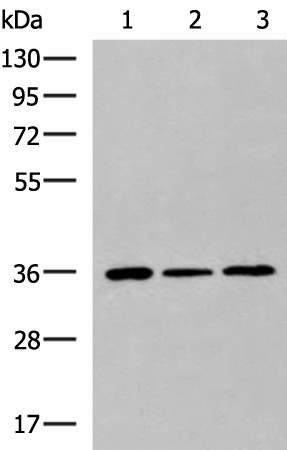 Western blot analysis of HepG2 Hela cell Mouse liver tissue lysates  using KHK Polyclonal Antibody at dilution of 1:1000