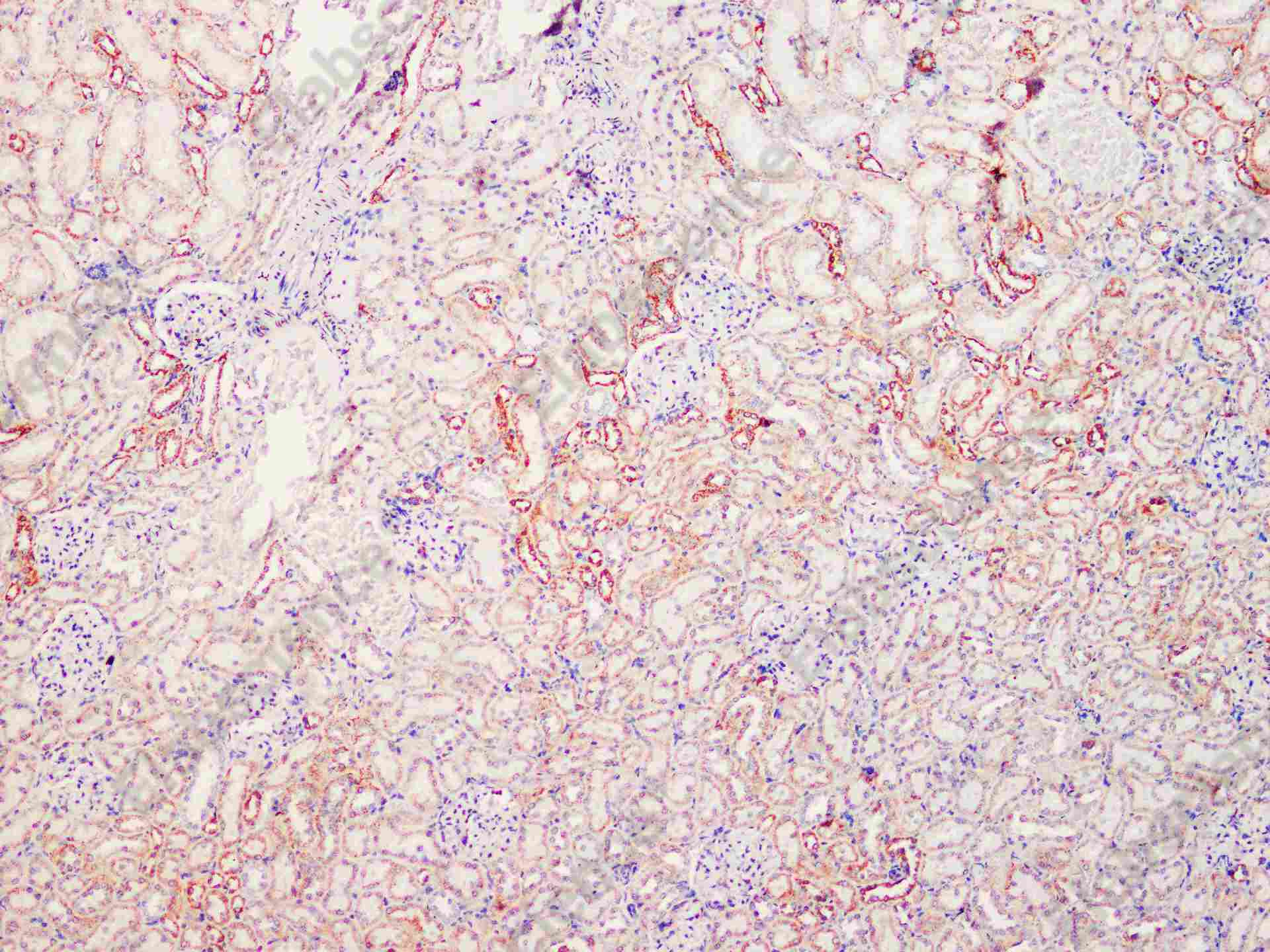 Recombinant SOD2 Monoclonal Antibody - 3