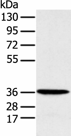 Western blot analysis of Human fetal liver tissue  using MAT2B Polyclonal Antibody at dilution of 1:1000