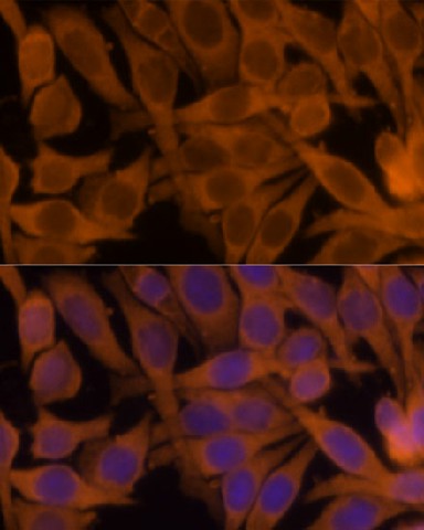 Immunofluorescence analysis of HeLa cells using NME1 Polyclonal Antibody at dilution of 1:100. Blue: DAPI for nuclear staining.