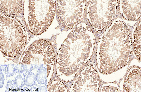 Immunohistochemistry of paraffin-embedded Rat testis tissue using Proliferating Cell Nuclear Antigen Monoclonal Antibody at dilution of 1:200.