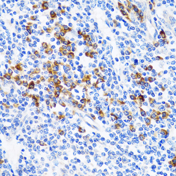 Immunohistochemistry of paraffin-embedded Human tonsil using TNFSF12 Polyclonal Antibody at dilution of 1:100 (40x lens).
