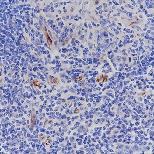 Recombinant Nestin Monoclonal Antibody - small - 4