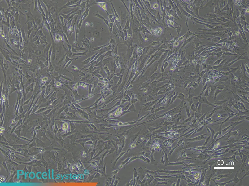 Mouse Vascular Adventitial FibroblastsMouse Vascular Adventitial Fibroblasts - 2