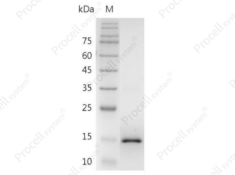 IL-17F/C87042, Mouse, Recombinant