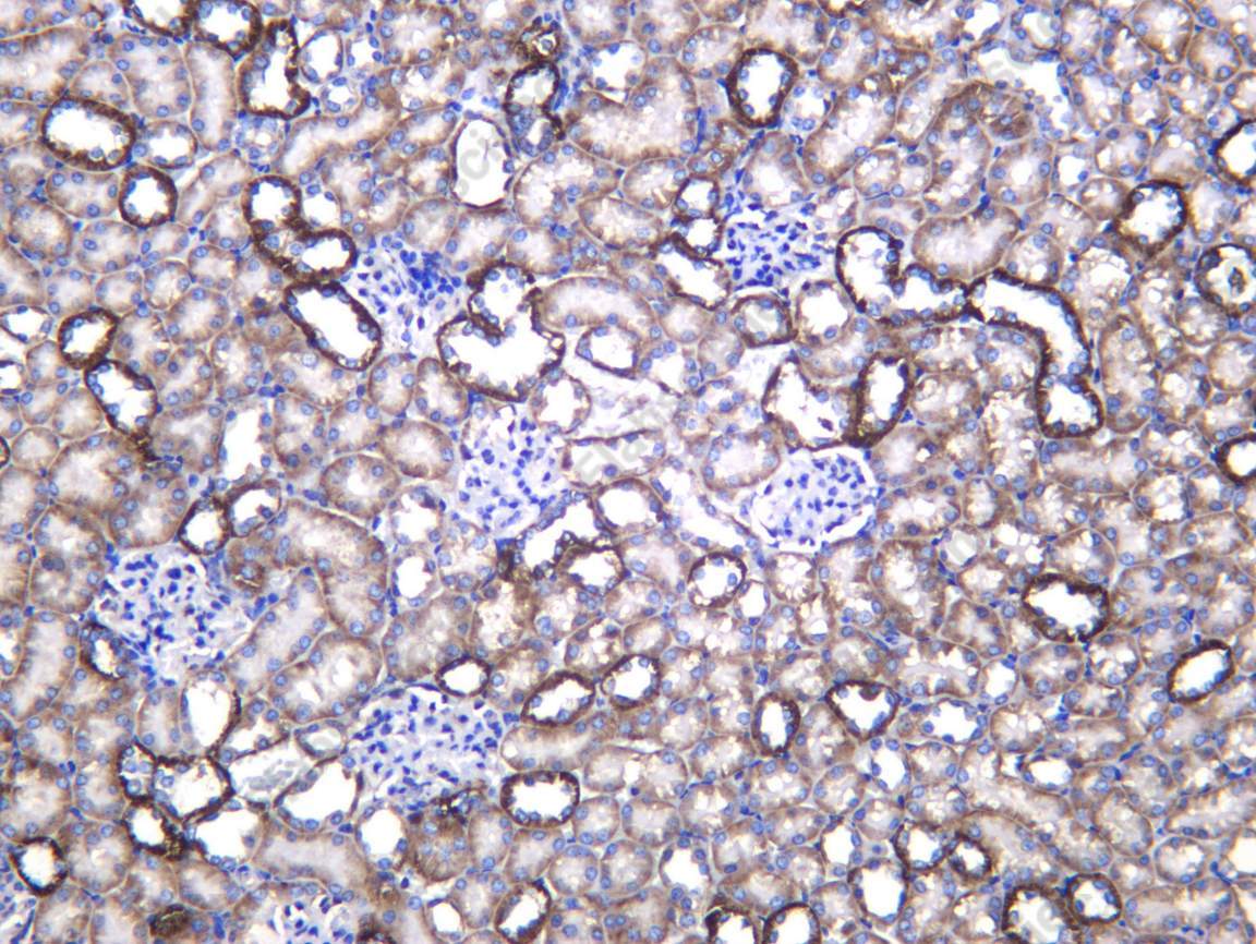 Recombinant CP27B Monoclonal Antibody - 2