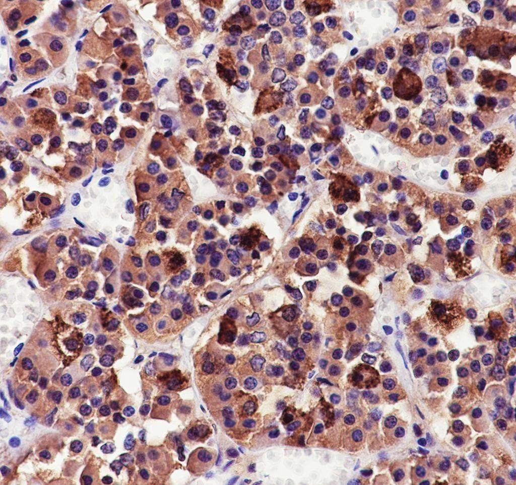 Recombinant CGA/hCG alpha Monoclonal Antibody - 3