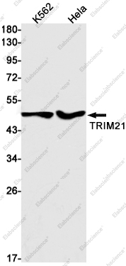 Recombinant TRIM21 Monoclonal Antibody - 1