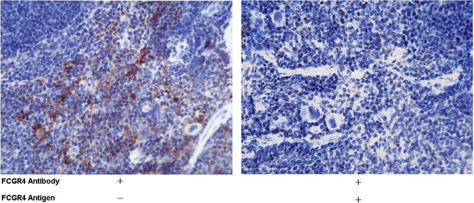 Recombinant CD16-2/FCGR4 Monoclonal Antibody-searchlist-1