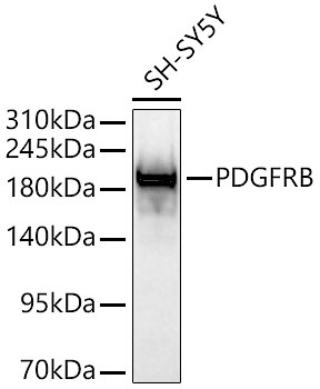 PDGFR beta Polyclonal Antibody - small - 8