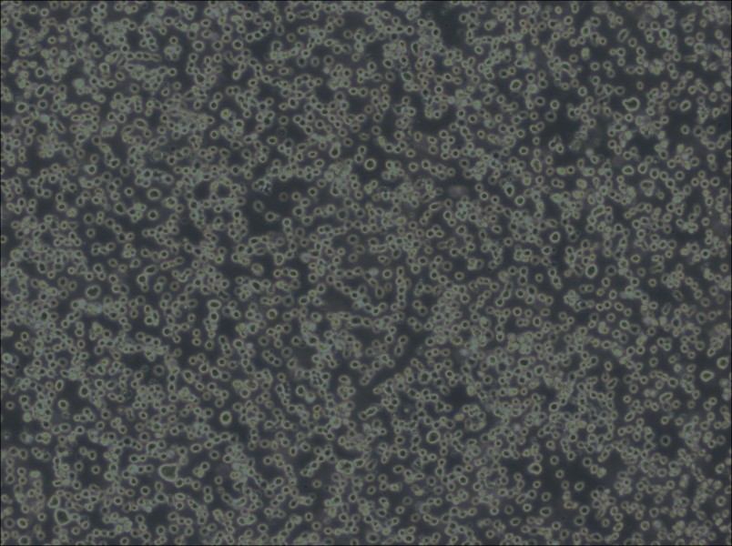 Karpas-299 Cell Complete MediumKarpas-299 Cell Complete Medium - 3