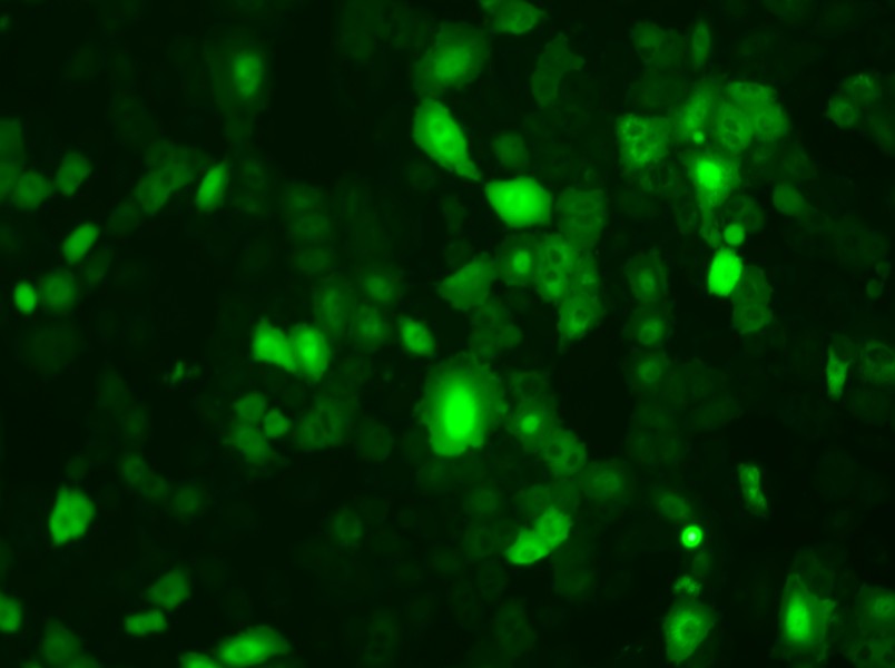 A549-GFP Cell Complete Medium - 3
