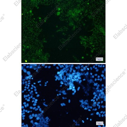 Recombinant Cytochrome P450 17A1/CYP17A1 Monoclonal Antibody - 3