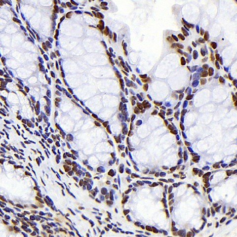 Immunohistochemistry analysis of paraffin-embedded mouse colon  using S100A4 Monoclonal Antibody at dilution of 1:300.