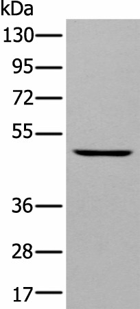 Western blot analysis of A431 cell  using DAPK2 Polyclonal Antibody at dilution of 1:400