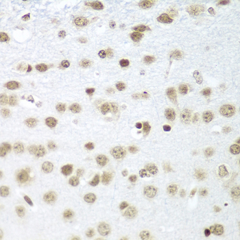Immunohistochemistry of paraffin-embedded Mouse brain using SAP18 Polyclonal Antibody at dilution of 1:100 (40x lens).