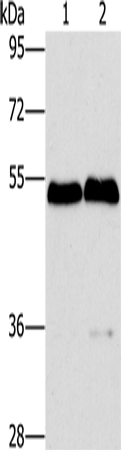 Western Blot analysis of Mouse brain and liver tissue using SPHK2 Polyclonal Antibody at dilution of 1:200