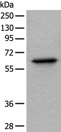 Western blot analysis of Hela cell lysate  using BAIAP2L1 Polyclonal Antibody at dilution of 1:1000