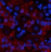 Immunofluorescence analysis of Human stomach tissue using TNF alpha Polyclonal Antibody at dilution of 1:200.