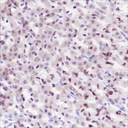 Recombinant MCM5 Monoclonal Antibody - 3