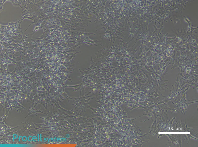 Chicken Follicle Granulosa Cell Complete Medium - 2