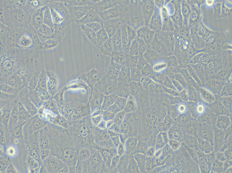 HCC-78 Cell Complete Medium - 5