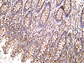 Recombinant NDRG2 Monoclonal Antibody - 1
