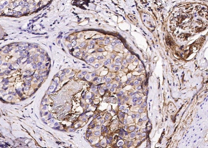 S100A10 Monoclonal Antibody - small - 5