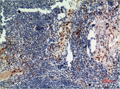 Immunohistochemistry of paraffin-embedded Human tonsil tissue using ERK 1 Monoclonal Antibody at dilution of 1:200.