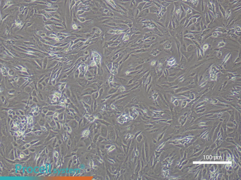 Mouse  Follicle Membrane Cell Complete Medium - 3