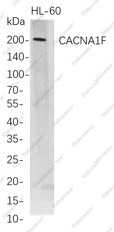 Recombinant CACNA1F Monoclonal Antibody - 1