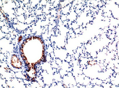 Immunohistochemistry of paraffin-embedded Mouse lung tissue using TGFB1 Monoclonal Antibody at dilution of 1:200.