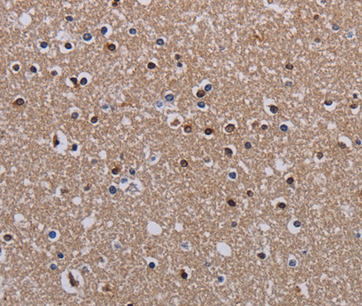 Immunohistochemistry of paraffin-embedded Human brain using MECP2 Polyclonal Antibody at dilution of 1:60