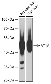 Western blot analysis of extracts of various cell lines using MAT1A Polyclonal Antibody at 1:1000 dilution.