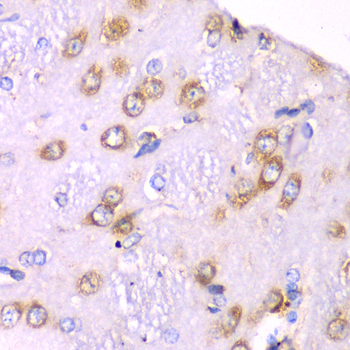 Immunohistochemistry of paraffin-embedded Rat brain using RPS3A Polyclonal Antibody at dilution of 1:100 (40x lens).