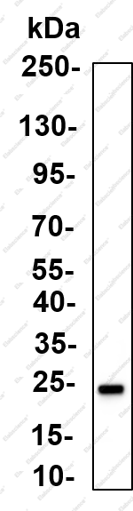 Recombinant Rab 35 Monoclonal Antibody - 1