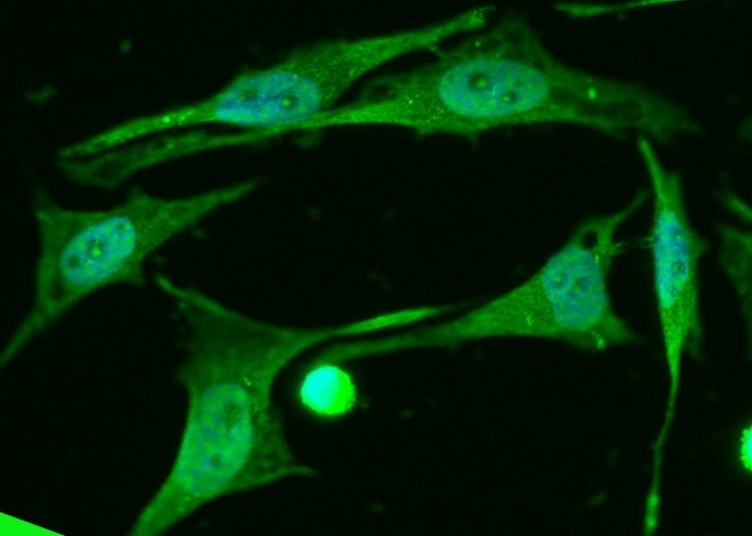 CREB1 Monoclonal Antibody - small - 2