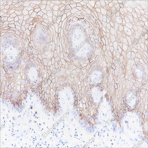 Recombinant CD138/Syndecan-1 Monoclonal Antibody - 1