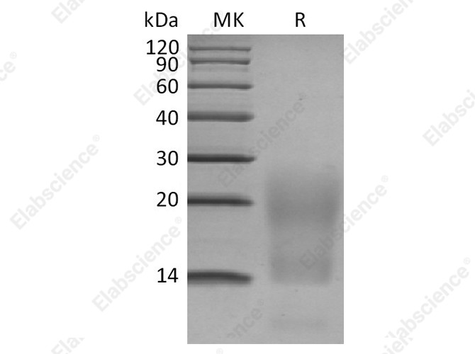 Recombinant Human BCMA/TNFRSF17 Protein (His Tag) - 1