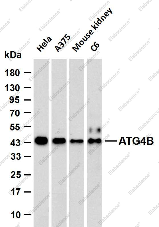 Recombinant ATG4B Monoclonal Antibody - 1