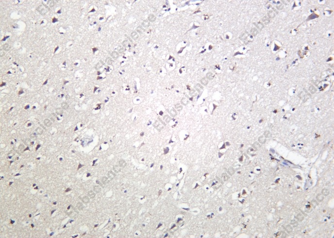 Recombinant Phospho-STAT3 (Ser727) Monoclonal Antibody - 2